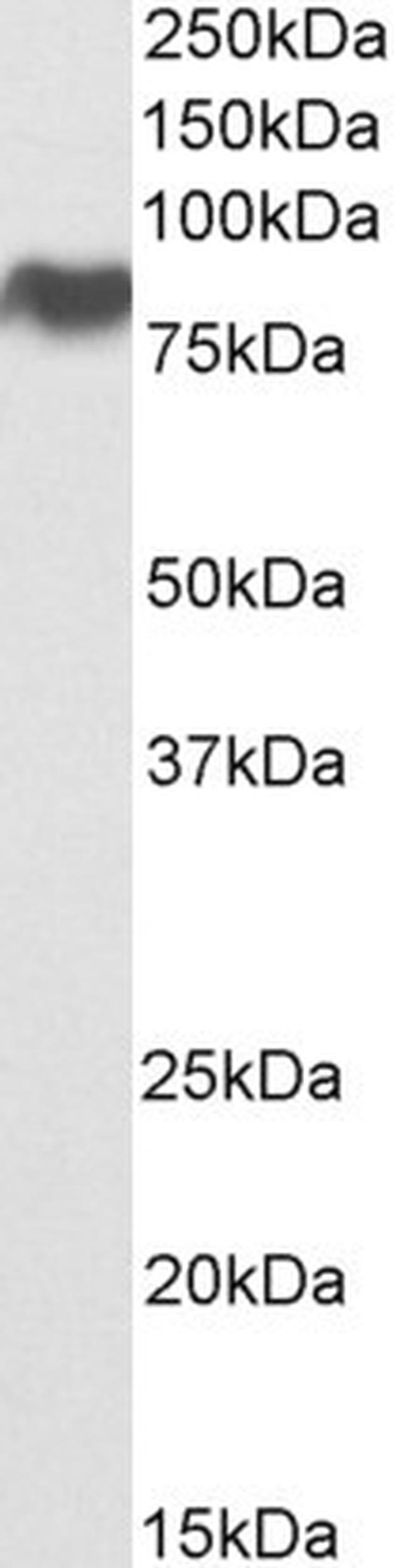 SR-BI Antibody in Western Blot (WB)