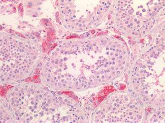 SR-BI Antibody in Immunohistochemistry (Paraffin) (IHC (P))