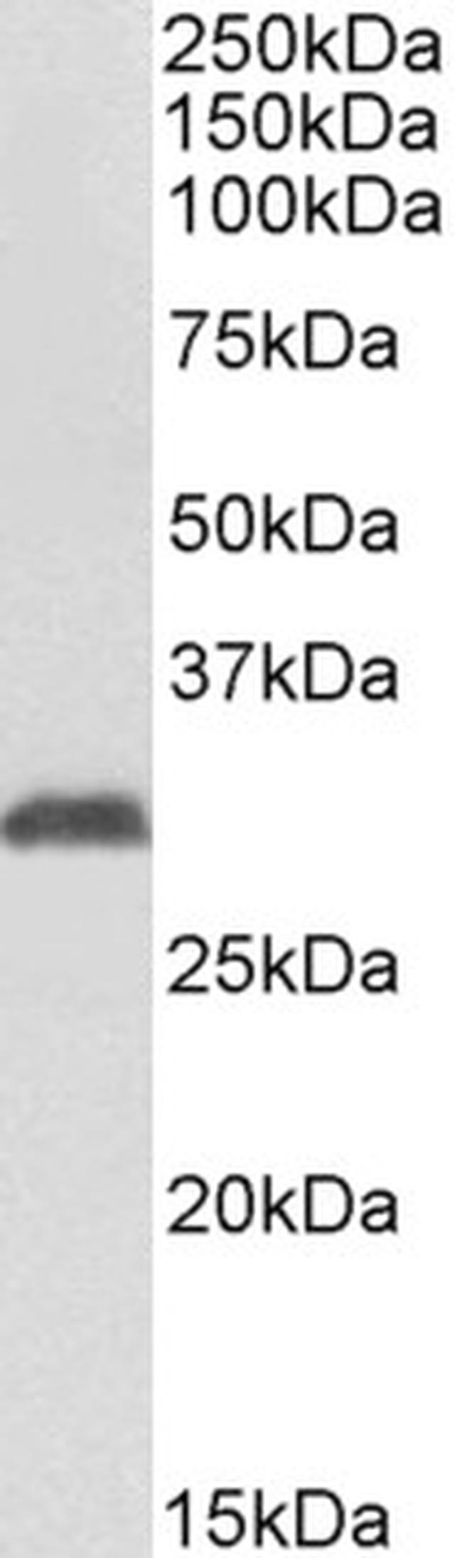 NAT1 Antibody in Western Blot (WB)