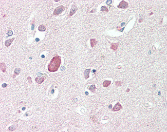 PTGDS Antibody in Immunohistochemistry (Paraffin) (IHC (P))