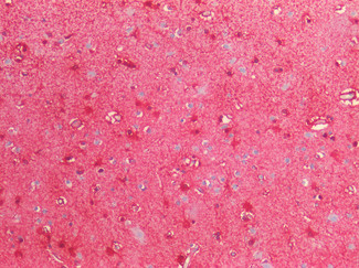 S100B Antibody in Immunohistochemistry (Paraffin) (IHC (P))