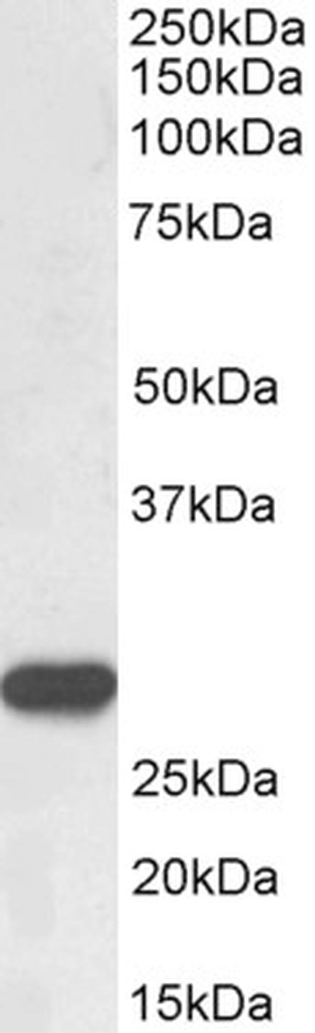 PR3 Antibody in Western Blot (WB)