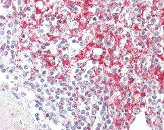 ADAM19 Antibody in Immunohistochemistry (Paraffin) (IHC (P))