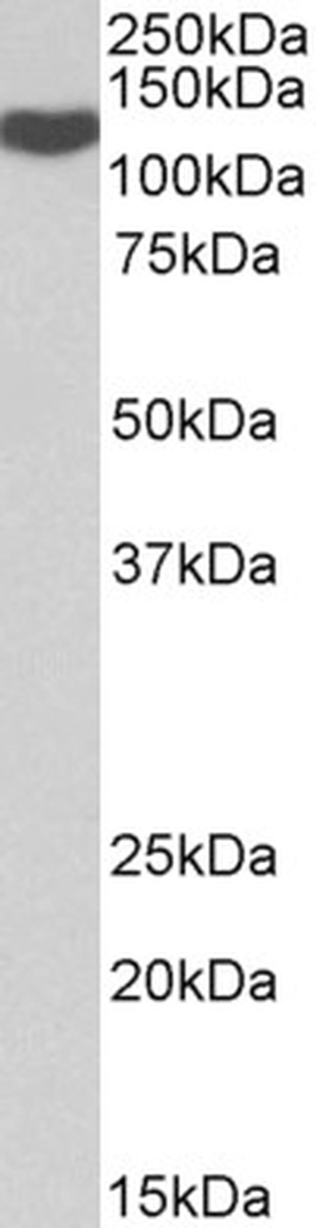 ADAM19 Antibody in Western Blot (WB)