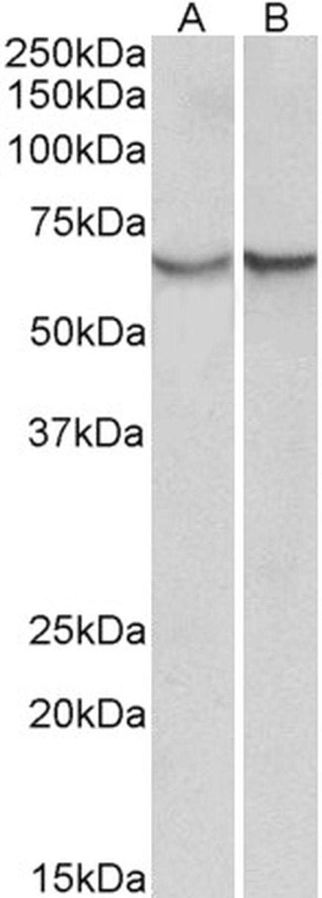 SERPINA3 Antibody in Western Blot (WB)