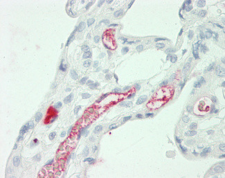 A2M Antibody in Immunohistochemistry (Paraffin) (IHC (P))