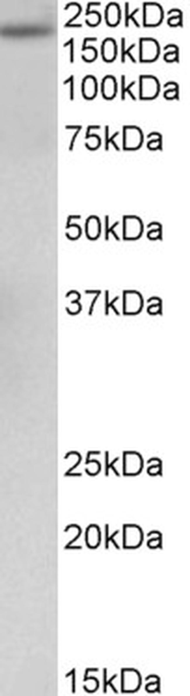 A2M Antibody in Western Blot (WB)