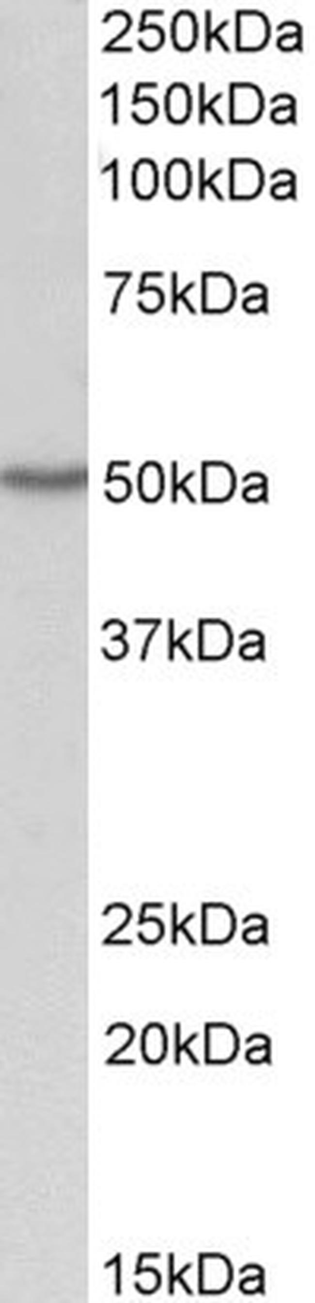 OAS1 Antibody in Western Blot (WB)