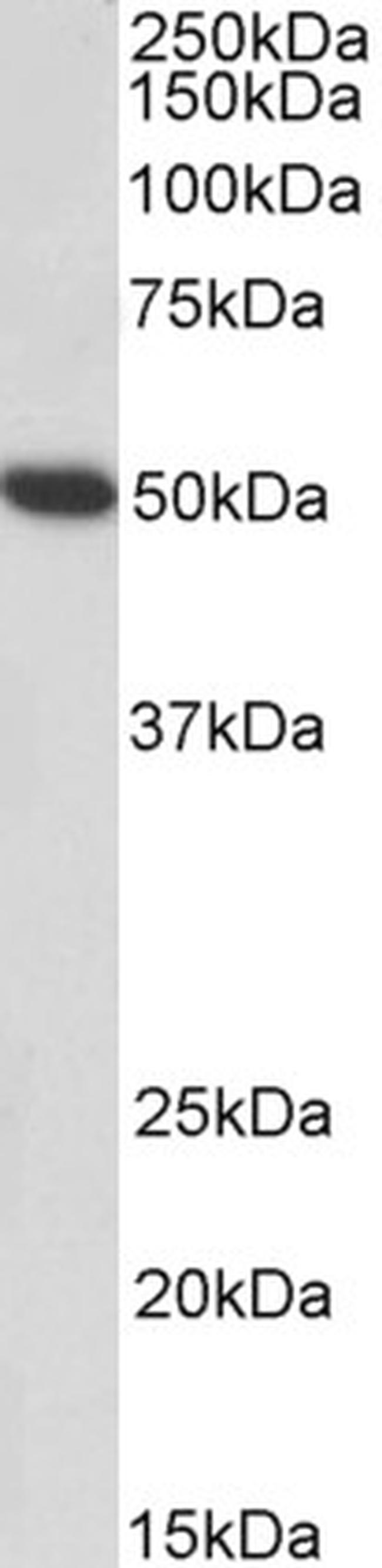 Fibrinogen gamma Antibody in Western Blot (WB)