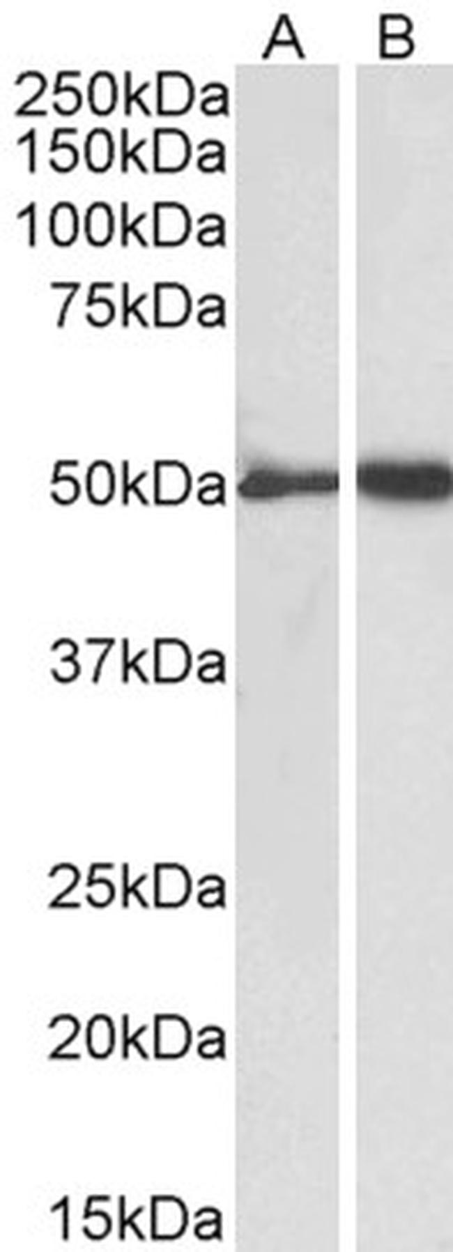 Fibrinogen gamma Antibody in Western Blot (WB)