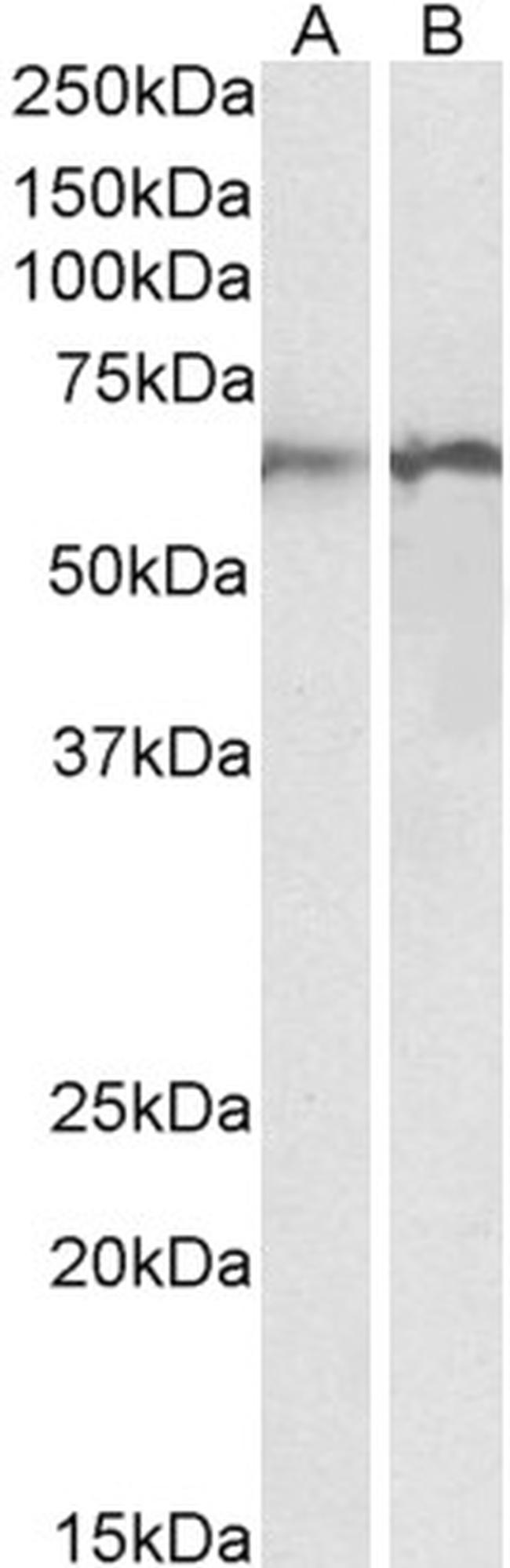 Calreticulin Antibody in Western Blot (WB)