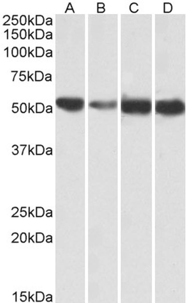 ATP5A1 Antibody in Western Blot (WB)