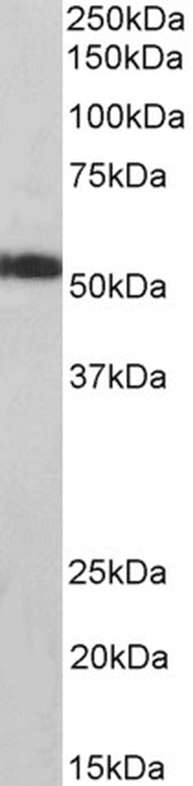 ATP5A1 Antibody in Western Blot (WB)