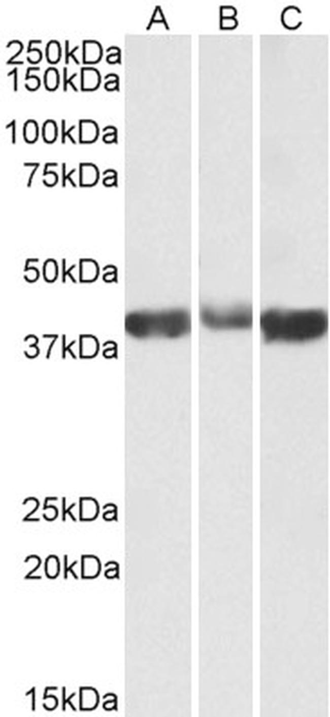 Aldolase A Antibody in Western Blot (WB)