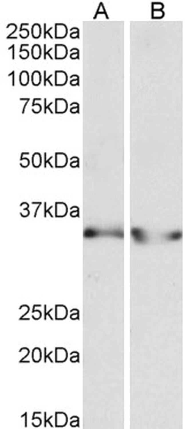 LDHB Antibody in Western Blot (WB)