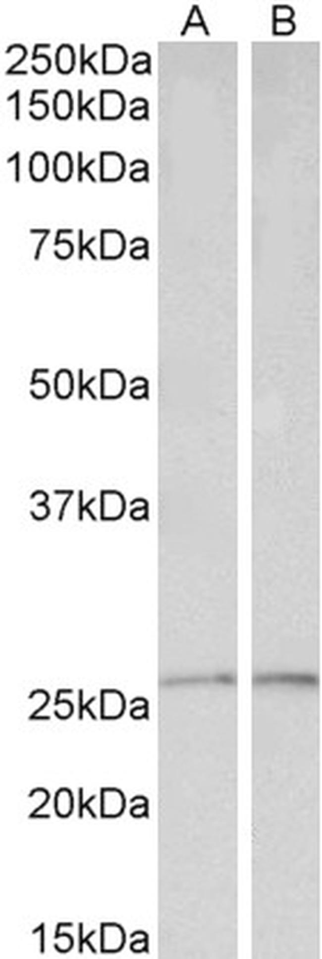 PRDX6 Antibody in Western Blot (WB)