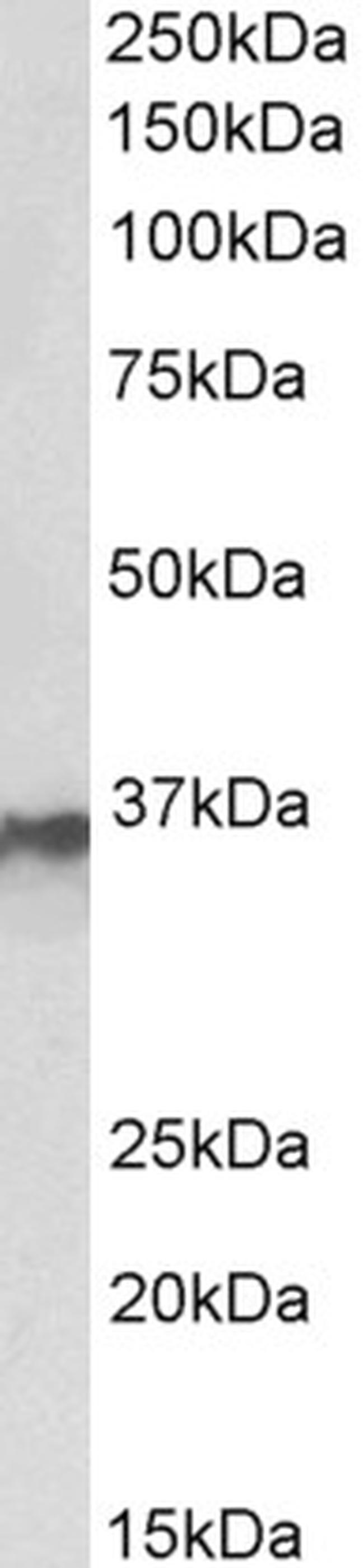 hnRNP A2B1 Antibody in Western Blot (WB)