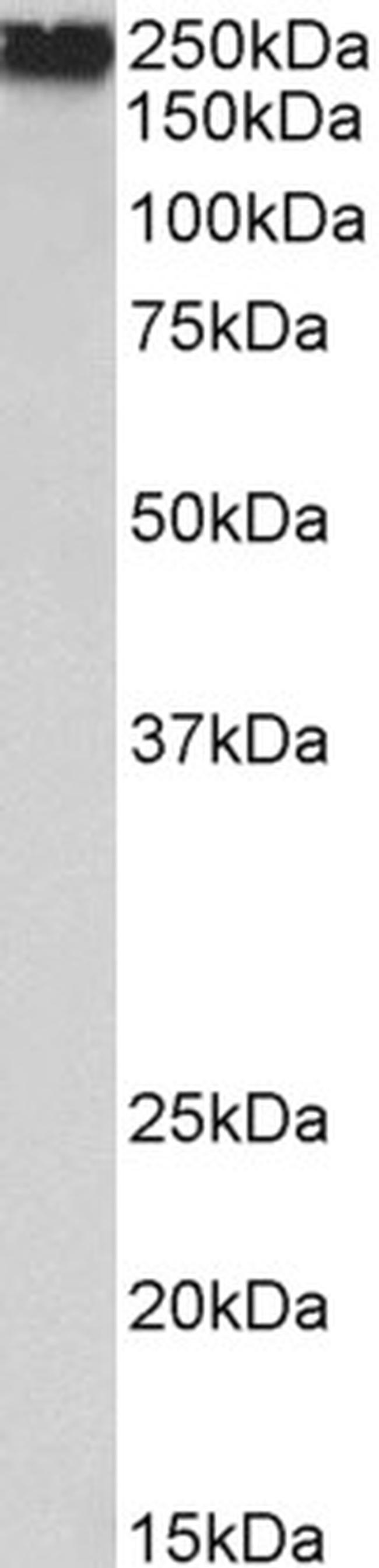 Filamin A Antibody in Western Blot (WB)