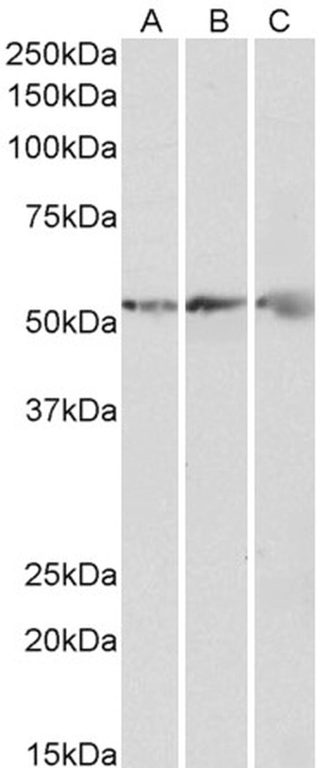 ATP Synthase beta Antibody in Western Blot (WB)