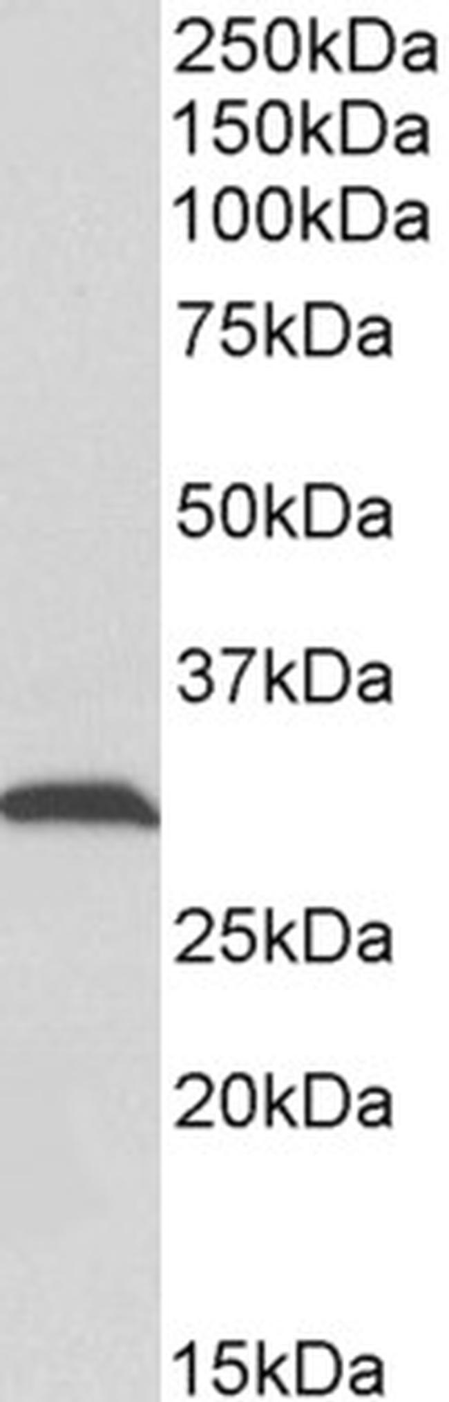 ATP Synthase gamma Antibody in Western Blot (WB)