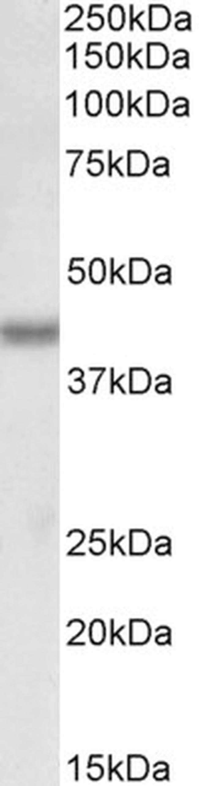 BMI-1 Antibody in Western Blot (WB)