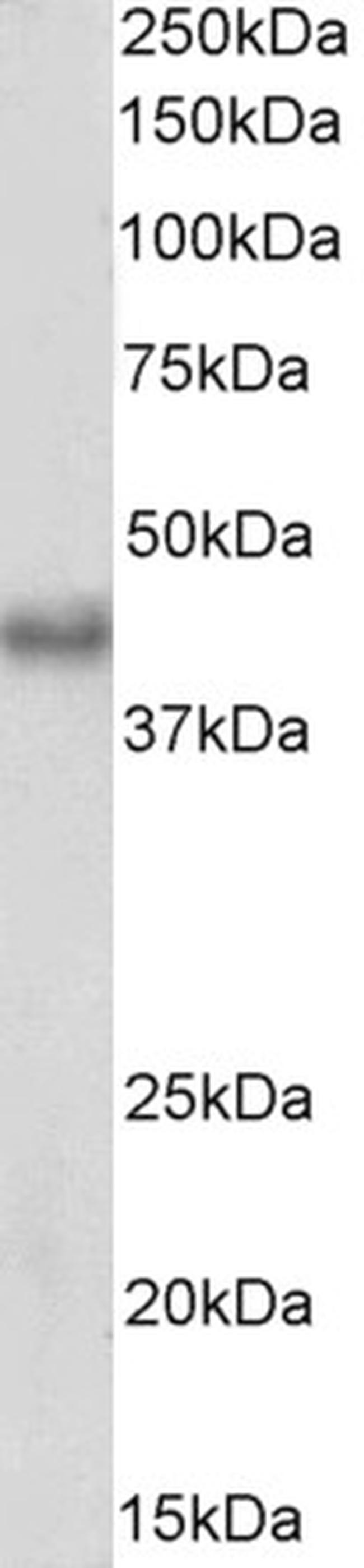 BMI-1 Antibody in Western Blot (WB)