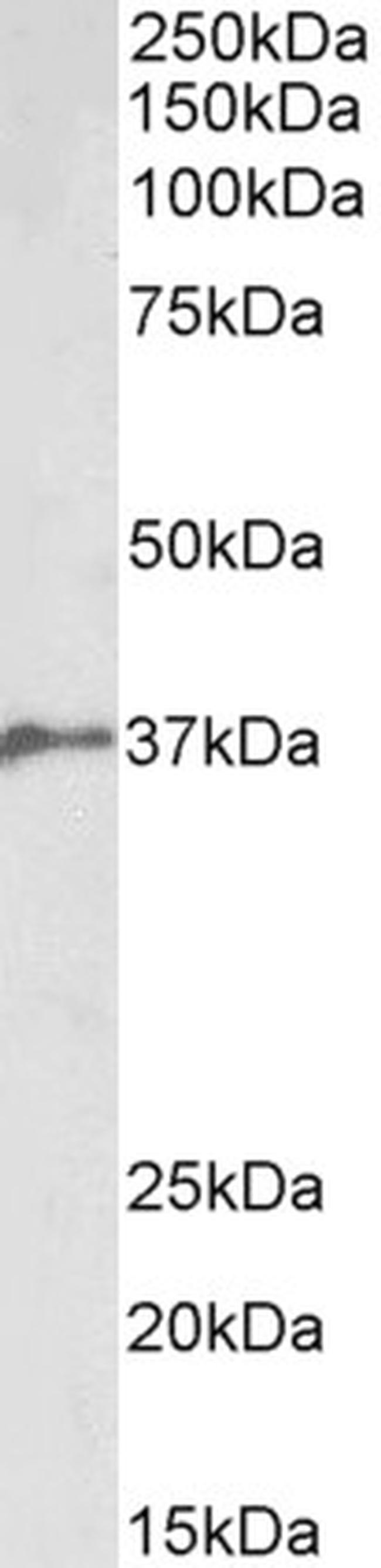 BMI-1 Antibody in Western Blot (WB)