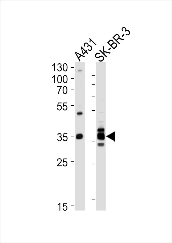 Annexin A2 Antibody in Western Blot (WB)