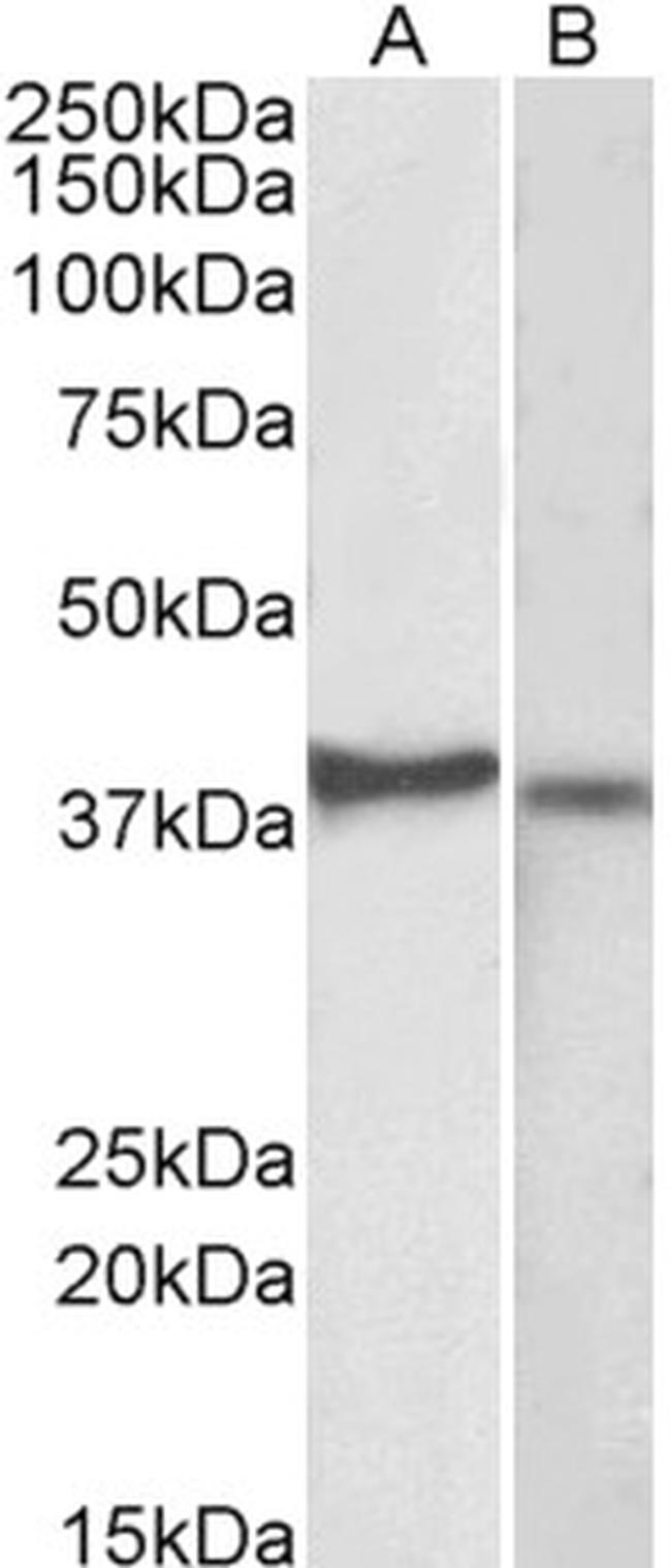 CX3CR1 Antibody in Western Blot (WB)