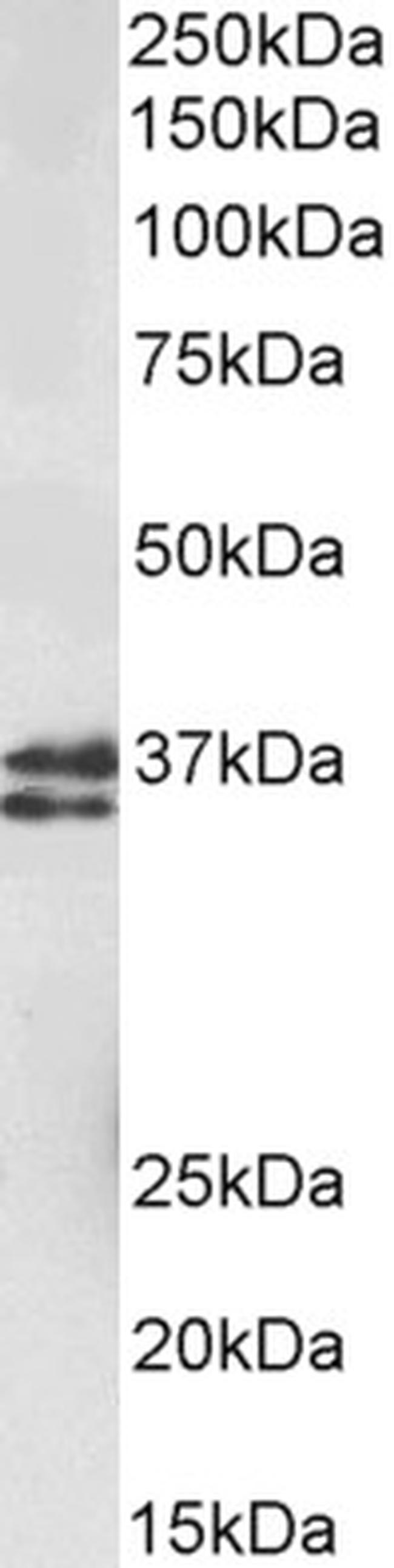 MSI2 Antibody in Western Blot (WB)