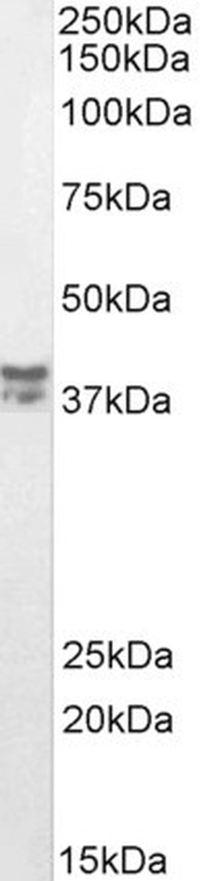 MSI2 Antibody in Western Blot (WB)