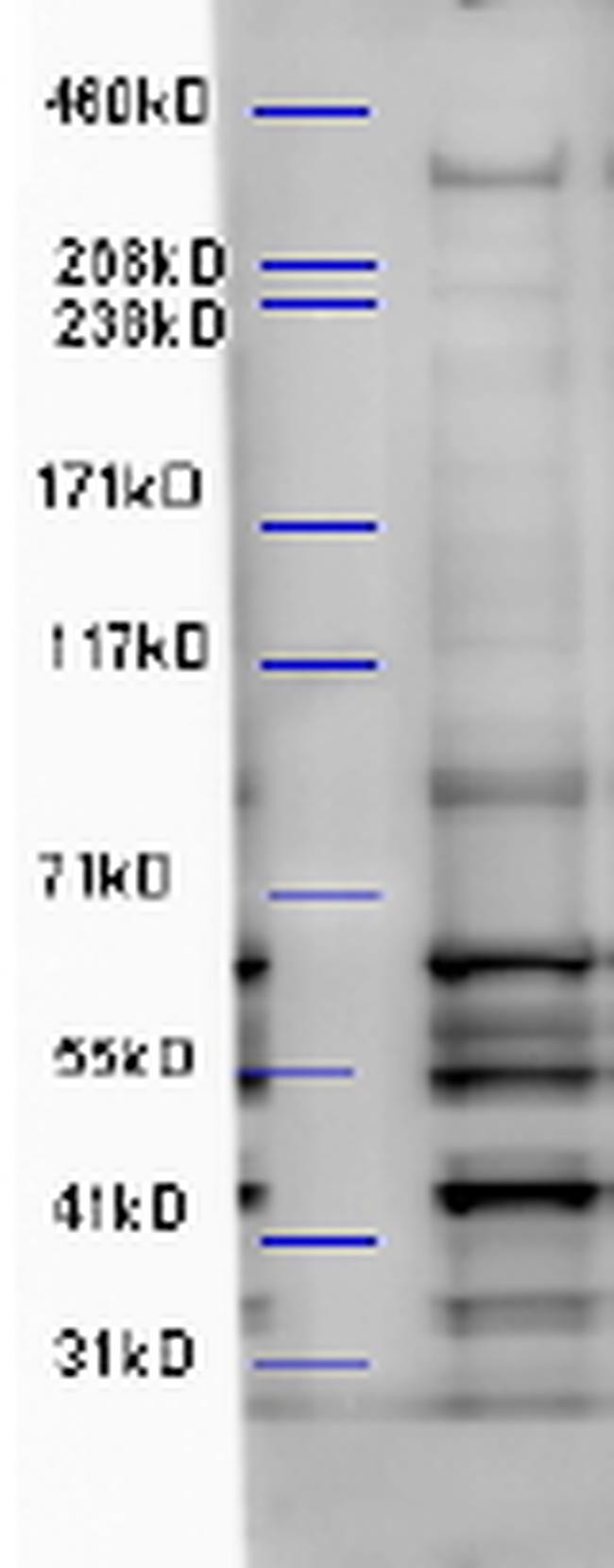 WDFY3 Antibody in Western Blot (WB)