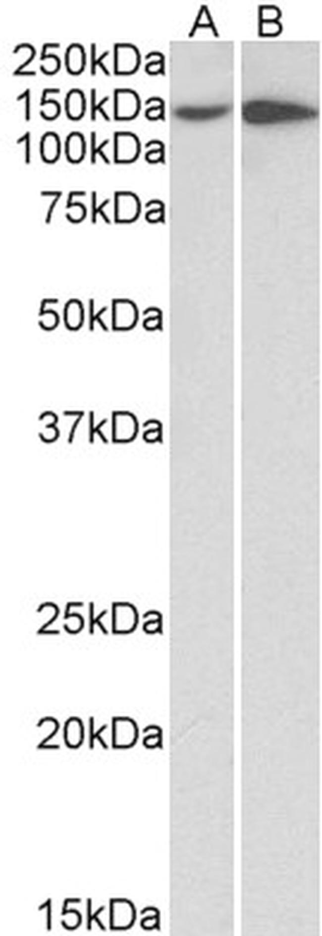 CD49a (Integrin alpha 1) Antibody in Western Blot (WB)