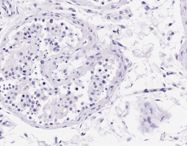 Acrosin Light Chain Antibody in Immunohistochemistry (Paraffin) (IHC (P))