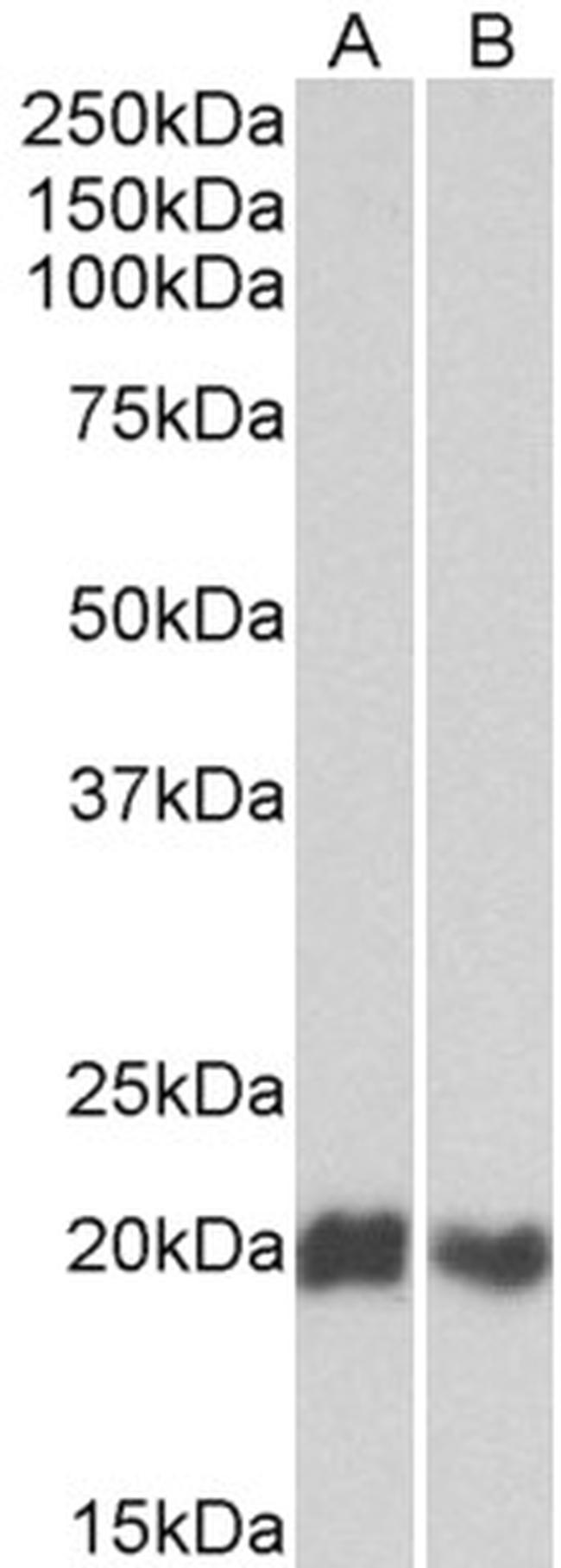 CD3d Antibody in Western Blot (WB)