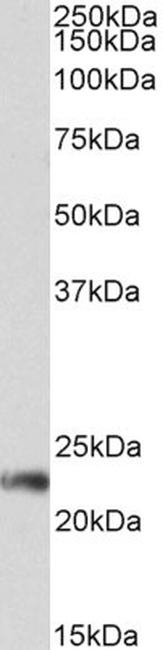 CD3g Antibody in Western Blot (WB)