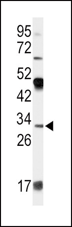 Apolipoprotein D Antibody in Western Blot (WB)