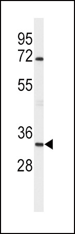Apolipoprotein D Antibody in Western Blot (WB)