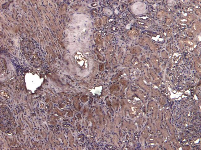 AIF Antibody in Immunohistochemistry (Paraffin) (IHC (P))