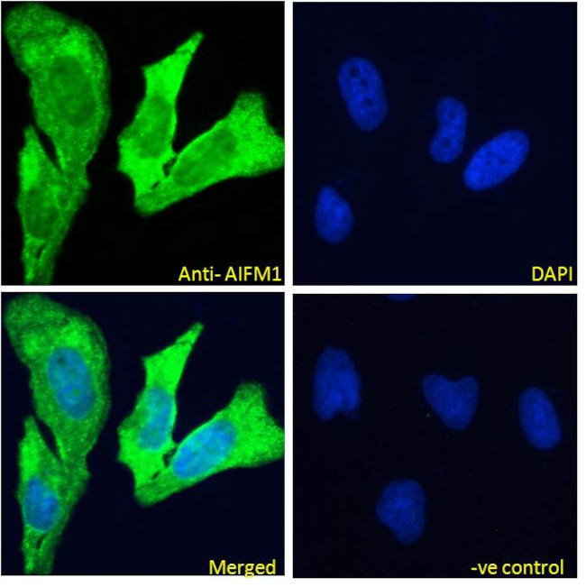 AIF Antibody in Immunocytochemistry (ICC/IF)