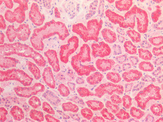 AIF Antibody in Immunohistochemistry (Paraffin) (IHC (P))