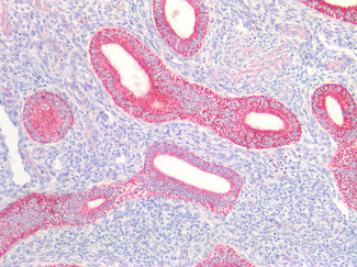 AIF Antibody in Immunohistochemistry (Paraffin) (IHC (P))