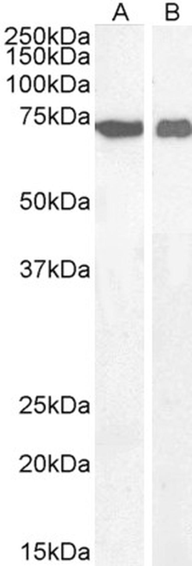 AIF Antibody in Western Blot (WB)