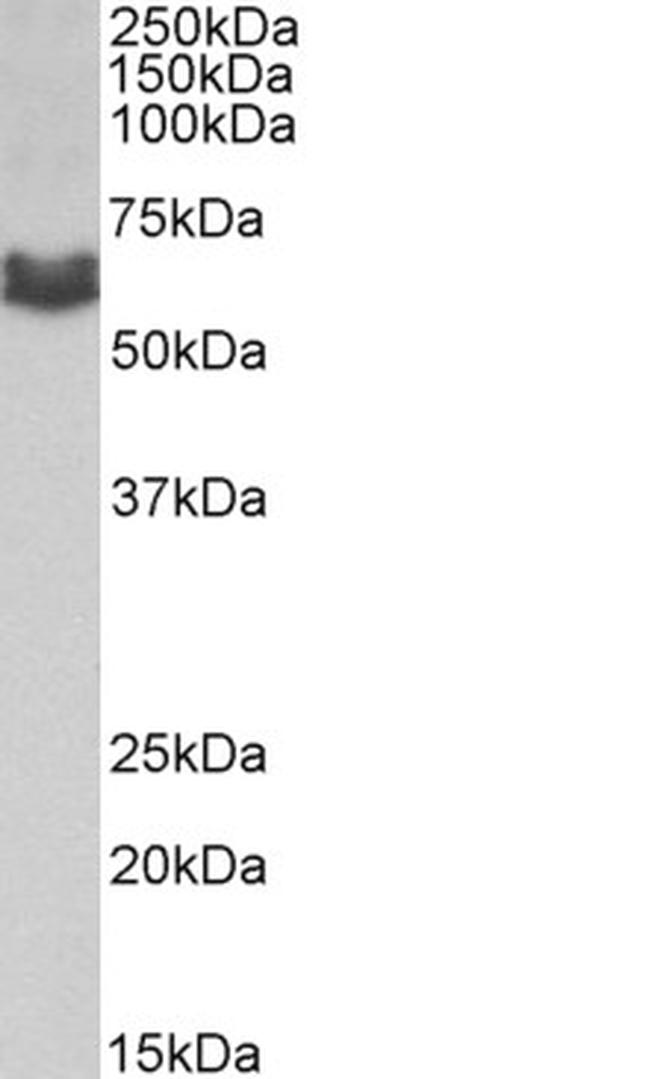 AMHR2 Antibody in Western Blot (WB)