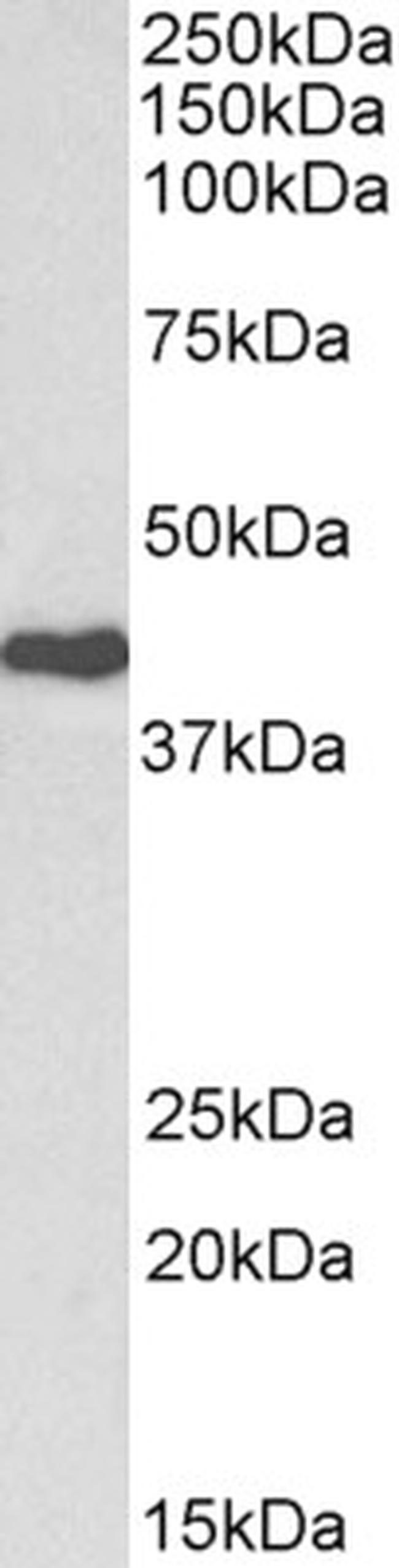 CDK7 Antibody in Western Blot (WB)