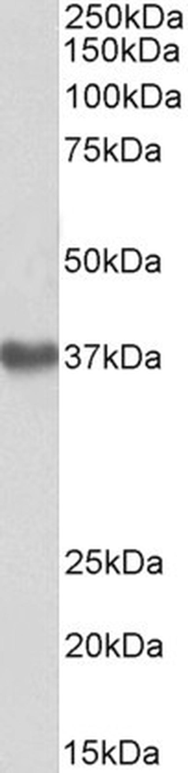 GNA12 Antibody in Western Blot (WB)