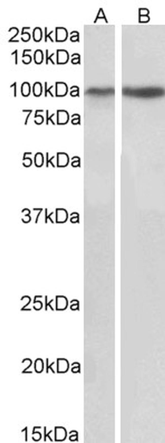 CD49c (Integrin alpha 3) Antibody in Western Blot (WB)