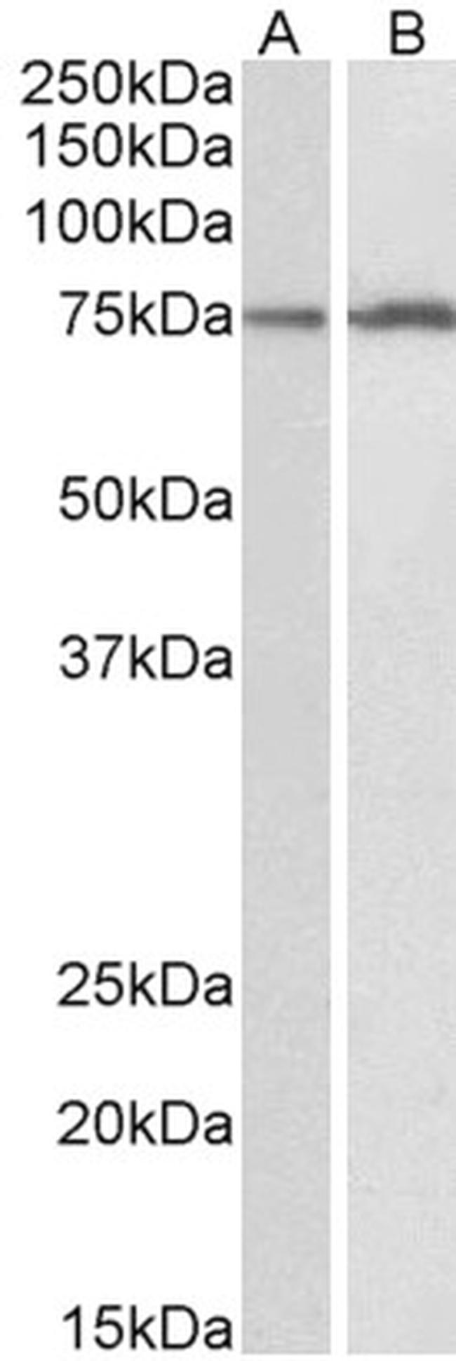 CYP2B6 Antibody in Western Blot (WB)