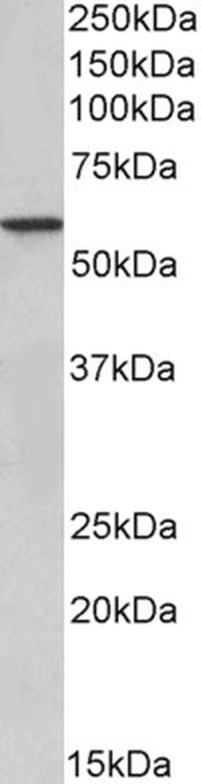 EPHX2 Antibody in Western Blot (WB)