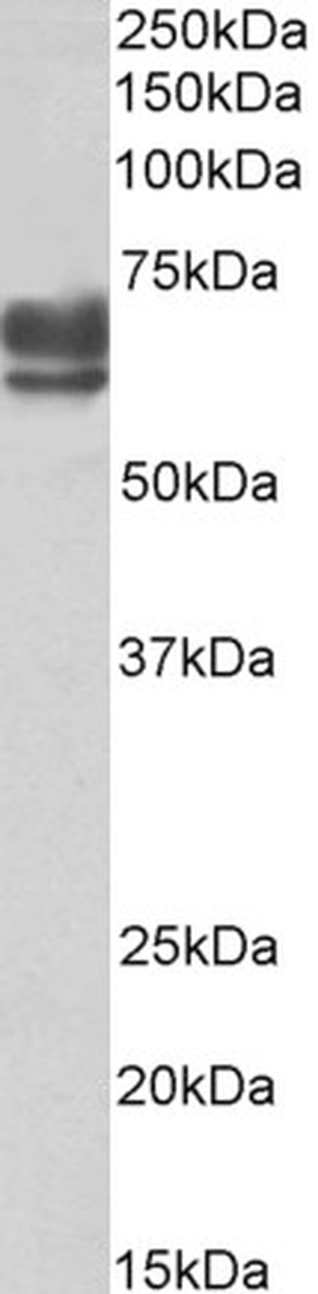 PEX5 Antibody in Western Blot (WB)